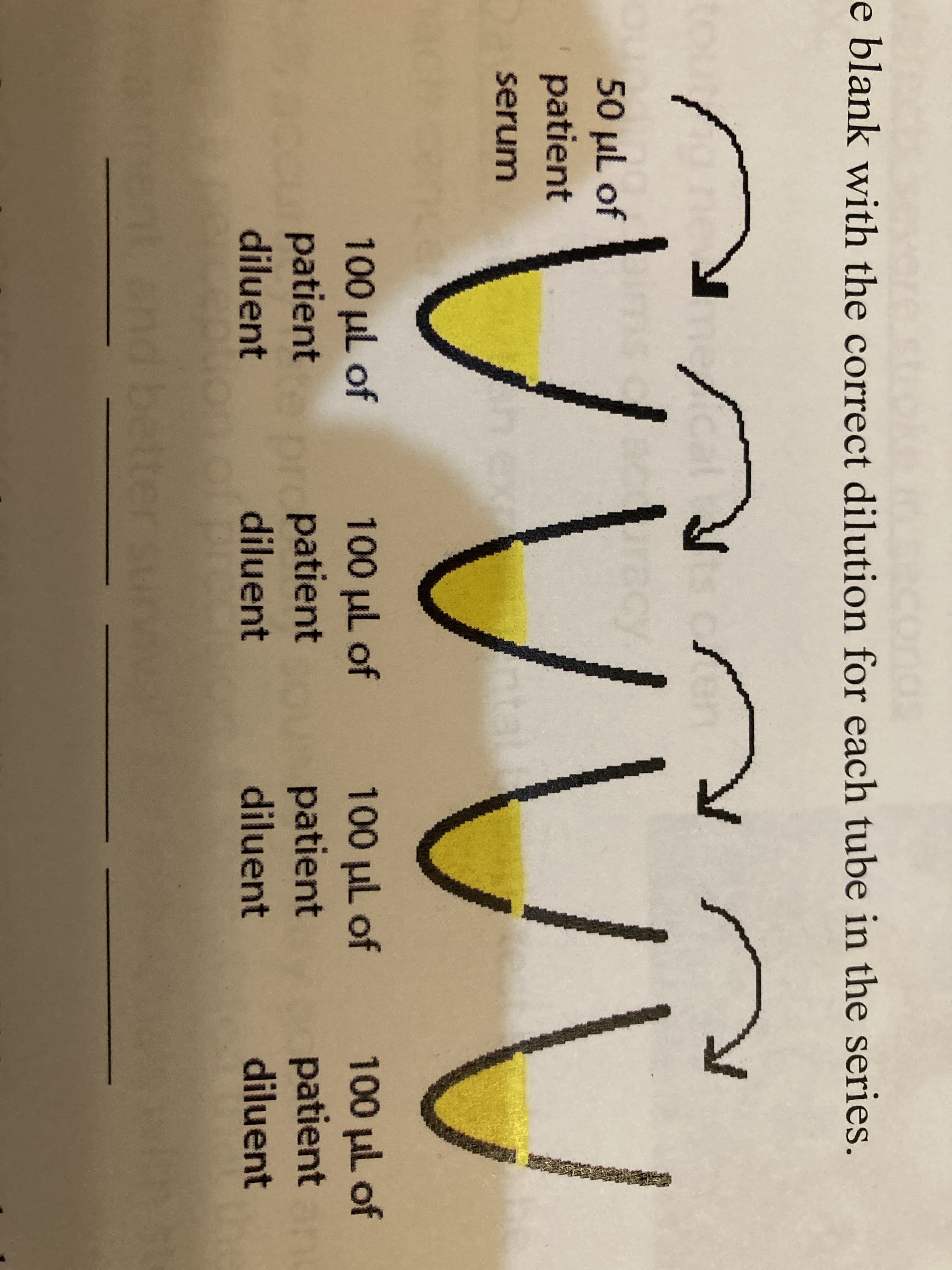 ands
e blank with the correct dilution for each tube in the series.
cy
50 µL of
patient
serum
100 µl of
patient
diluent
patient
diluent
100 µl of 100 uL of 100 µl of
patient
diluent
patient
diluent
better survi
