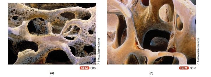 SEM 30x
SEM 30x
(a)
(b)
P. Motta/Science Source
P. Motta/Science Source
