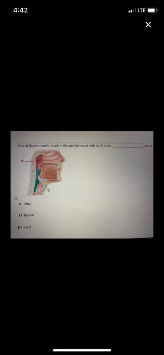 4:42
l LTE |
One of the two tonsils found in the area indicated with the X is the
tonsil
D) tubal
A) lingual
B) nasal
