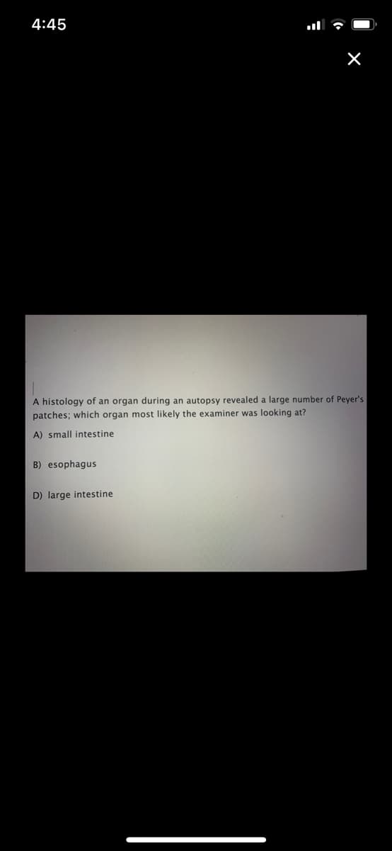 4:45
A histology of an organ during an autopsy revealed a large number of Peyer's
patches; which organ most likely the examiner was looking at?
A) small intestine
B) esophagus
D) large intestine

