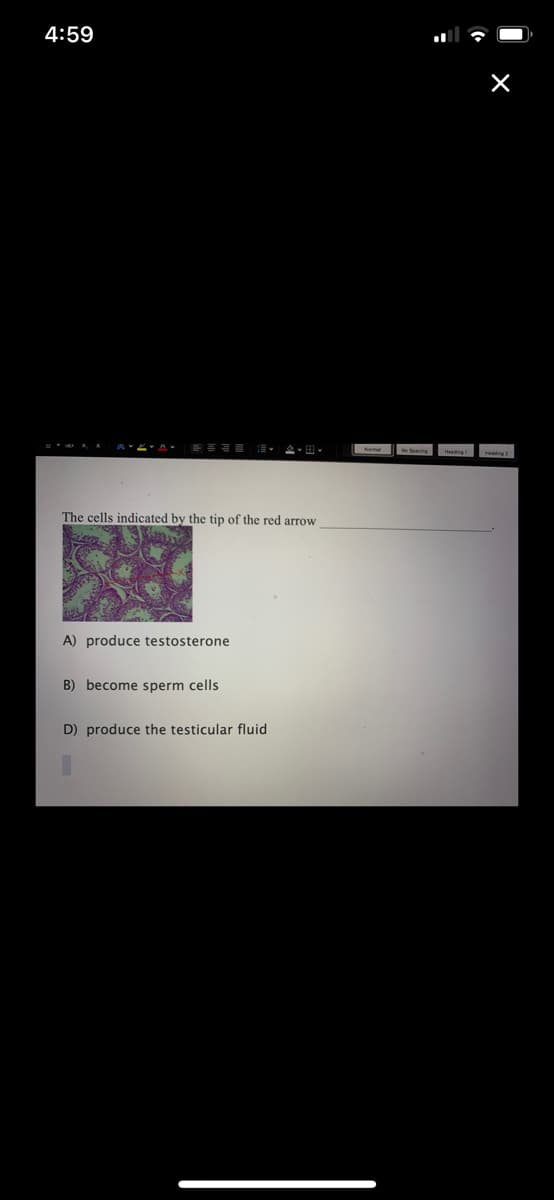 4:59
The cells indicated by the tip of the red arrow
A) produce testosterone
B) become sperm cells
D) produce the testicular fluid
