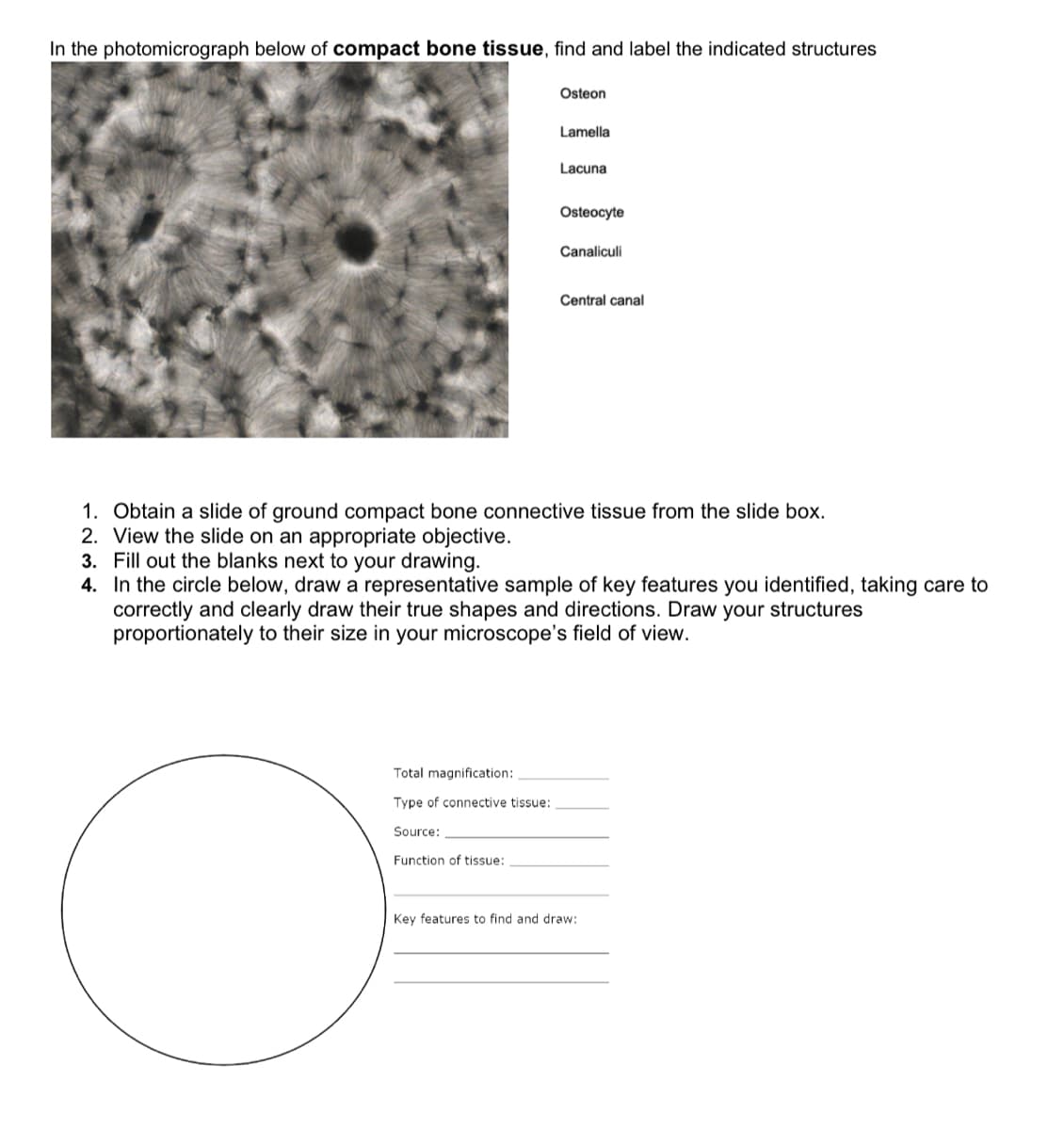 In the photomicrograph below of compact bone tissue, find and label the indicated structures
Osteon
Lamella
Lacuna
Osteocyte
Canaliculi
Central canal
1. Obtain a slide of ground compact bone connective tissue from the slide box.
2. View the slide on an appropriate objective.
3. Fill out the blanks next to your drawing.
4. In the circle below, draw a representative sample of key features you identified, taking care to
correctly and clearly draw their true shapes and directions. Draw your structures
proportionately to their size in your microscope's field of view.
Total magnification:
Type of connective tissue:
Source:
Function of tissue:
Key features to find and draw:
