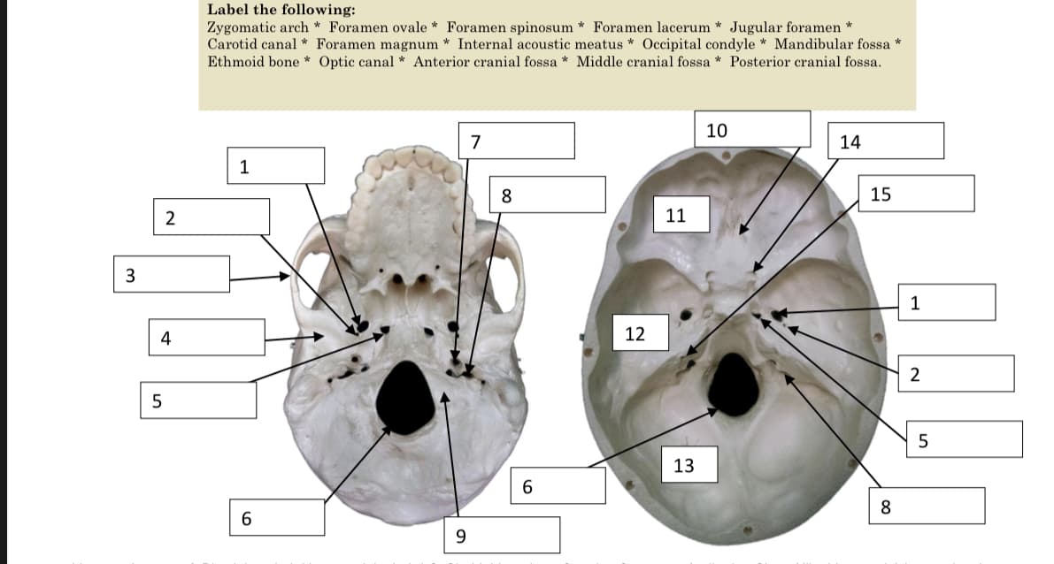 Label the following:
Zygomatic arch * Foramen ovale * Foramen spinosum * Foramen lacerum * Jugular foramen *
Carotid canal * Foramen magnum * Internal acoustic meatus * Occipital condyle * Mandibular fossa *
Ethmoid bone * Optic canal * Anterior cranial fossa * Middle cranial fossa * Posterior cranial fossa.
10
7
14
1
8
15
2
11
1
12
2
13
8
9.
