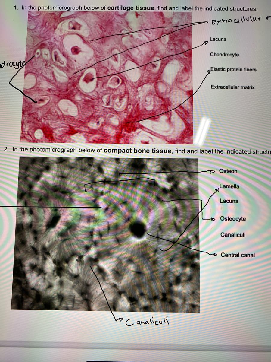 1. In the photomicrograph below of cartilage tissue, find and label the indicated structures.
Extra cellul(ar m
Lacuna
Chondrocyte
droyte
Elastic protein fibers
Extracellular matrix
2. In the photomicrograph below of compact bone tissue, find and label the indicated structu
p Osteon
Lamella
Lacuna
o Osteocyte
Canaliculi
» Central canal
Canaliculi
