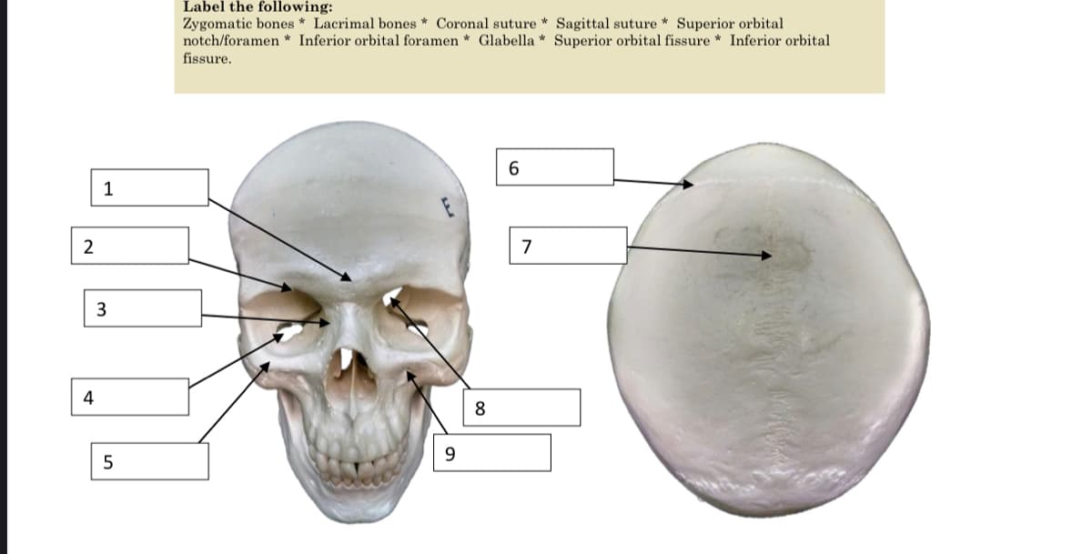 Label the following:
Zygomatic bones * Lacrimal bones * Coronal suture * Sagittal suture * Superior orbital
notch/foramen * Inferior orbital foramen * Glabella * Superior orbital fissure * Inferior orbital
fissure.
1
2
7
4
8
