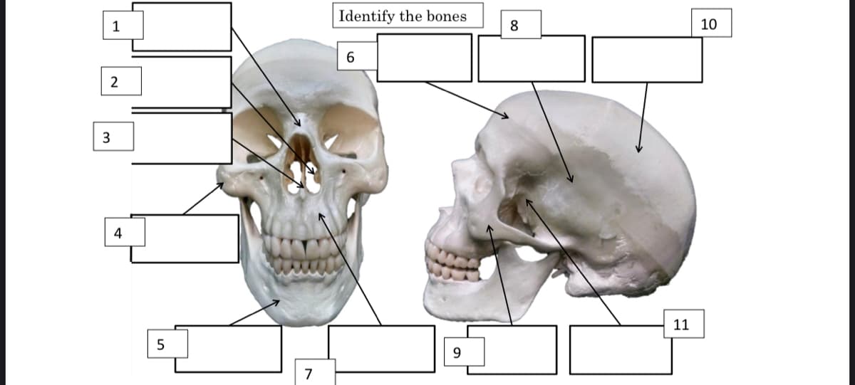 Identify the bones
1
10
4
11
7
