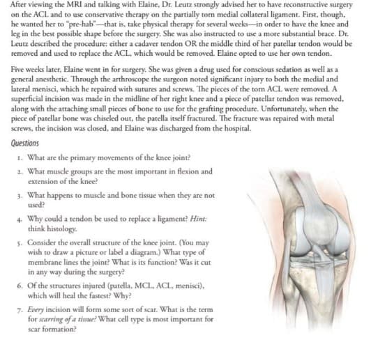 After viewing the MRI and talking with Elaine, Dr. Leutz strongly advised her to have reconstructive surgery
on the ACL and to use conservative therapy on the partially torn medial collateral ligament. First, though,
he wanted her to "pre-hab"-that is, take physical therapy for several weeks-in order to have the knee and
leg in the best possible shape before the surgery. She was also instructed to use a more substantial brace. Dr.
Leutz described the procedure: either a cadaver tendon OR the middle third of her patellar tendon would be
removed and used to replace the ACL, which would be removed. Elaine opted to use her own tendon.
Five weeks later, Elaine went in for surgery. She was given a drug used for conscious sedation as well as a
general anesthetic. Through the arthroscope the surgeon noted significant injury to both the medial and
lateral menisci, which he repaired with sutures and screws. The pieces of the torn ACL were removed. A
superficial incision was made in the midline of her right knee and a piece of patellar tendon was removed,
along with the attaching small pieces of bone to use for the grafting procedure. Unfortunately, when the
piece of patellar bone was chiseled out, the patella itself fractured. The fracture was repaired with metal
screws, the incision was closed, and Elaine was discharged from the hospital.
Questions
1. What are the primary movements of the knee joint?
2. What muscle groups are the most important in flexion and
extension of the knee?
3. What happens to muscle and bone tissue when they are not
used?
4. Why could a tendon be used to replace a ligament? Hint:
think histology.
5. Consider the overall structure of the knee joint. (You may
wish to draw a picture or label a diagram.) What type of
membrane lines the joint? What is its function? Was it cut
in any way during the surgery?
6. Of the structures injured (patella, MCL, ACL, menisci),
which will heal the fastest? Why?
7. Every incision will form some sort of scar. What is the term
for scarring of a tissue? What cell type is most important for
scar formation?
