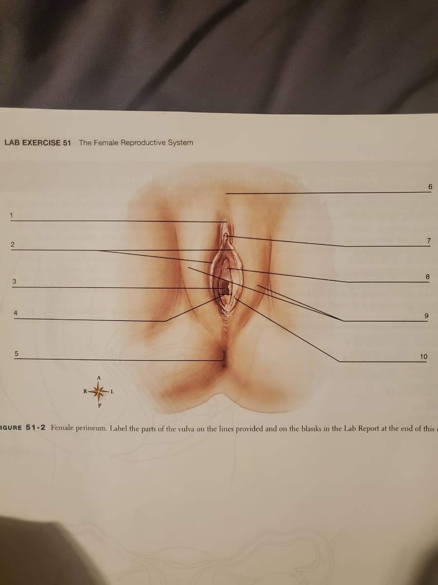 LAB EXERCISE 51 The Female Reproductive System
6
3
4
10
IGURE 51-2 Female perineum. Label the parts of the vulva on the lines provided and on the blanks in the Lab Report at the end of this
