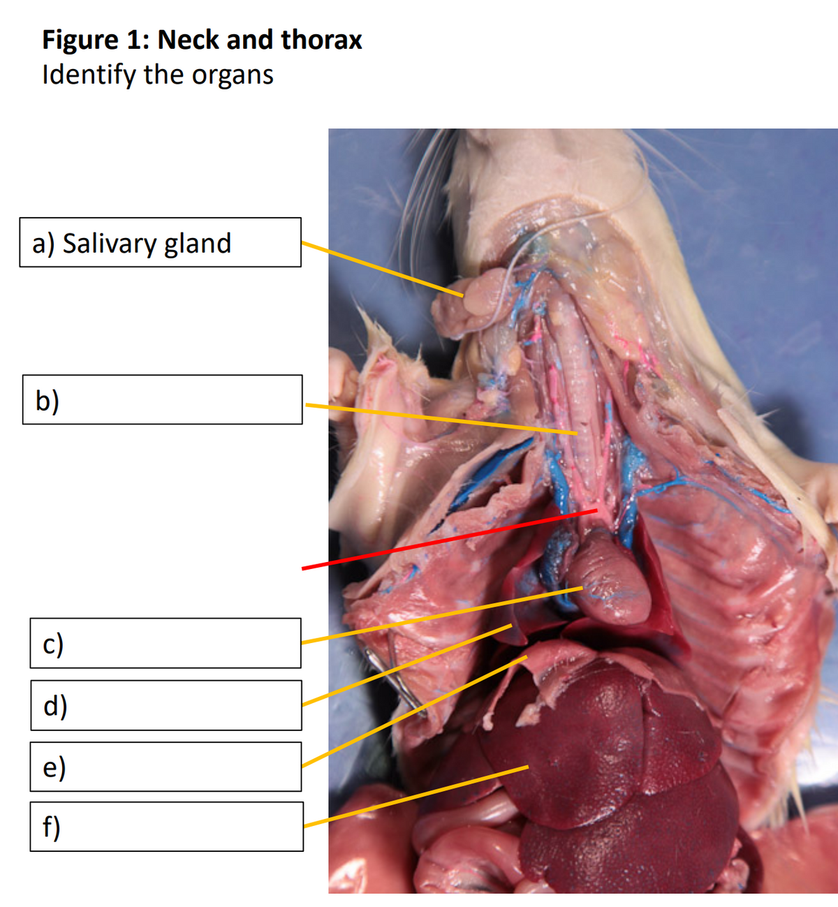 Figure 1: Neck and thorax
Identify the organs
a) Salivary gland
b)
c)
d)
e)
f)
