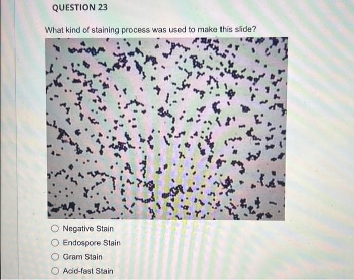 QUESTION 23
What kind of staining process was used to make this slide?
Negative Stain
Endospore Stain
Gram Stain
O Acid-fast Stain
So,