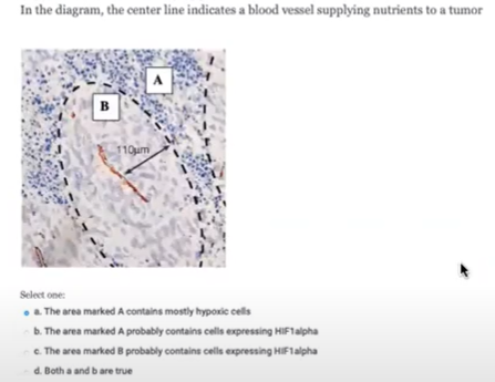 In the diagram, the center line indicates a blood vessel supplying nutrients to a tumor
110um
Select one:
. The area marked A contains mostly hypoxic cells
b. The area marked A probably contains cells expressing HIFTalpha
e. The area marked B probably contains cells expressing HIF1alpha
d. Both a and b are true
