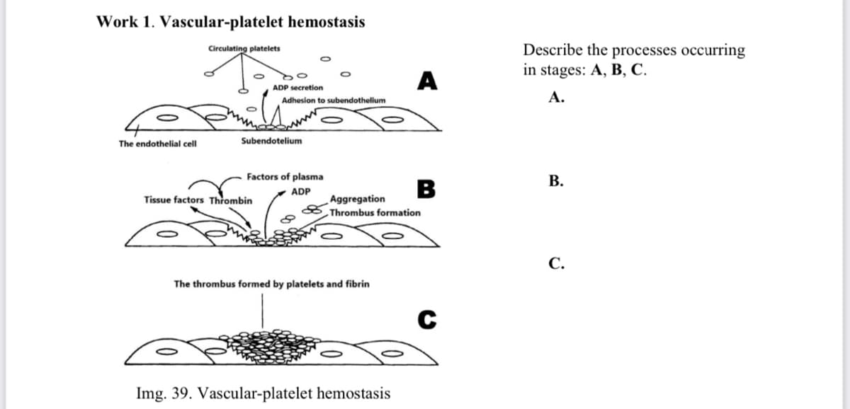 Work 1. Vascular-platelet hemostasis
Describe the processes occurring
in stages: A, B, C.
Circulating platelets
A
ADP secretion
Adhesion to subendothelium
А.
The endothelial cell
Subendotelium
Factors of plasma
В.
B
ADP
Tissue factors Thrombin
Aggregation
Thrombus formation
С.
The thrombus formed by platelets and fibrin
Img. 39. Vascular-platelet hemostasis
