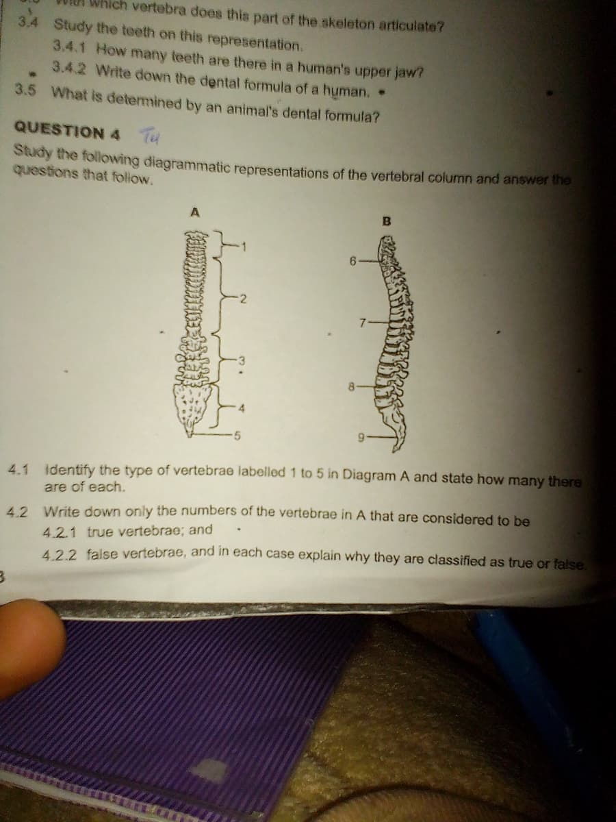 ich vertebra does this part of the skeleton articulate?
3.4
Study the teeth on this representation.
3.4.1 How many teeth are there in a human's upper jaw?
3.4.2 Write down the dental formula of a human.
3.5 What is detemined by an animal's dental formula?
QUESTION 4 T4
Stkky the following diagrammatic representations of the vertebral column and answer the
questions that follow.
6.
6.
4.1 identify the type of vertebrae labelled 1 to 5 in Diagram A and state how many there
are of each.
42 Write down only the numbers of the vertebrae in A that are considered to be
4.2.1 true vertebrae; and
422 false vertebrae, and in each case explain why they are classified as true or false
