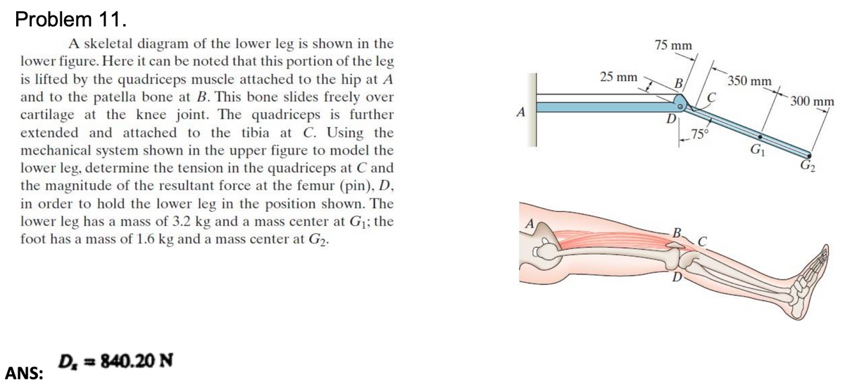 Problem 11.
A skeletal diagram of the lower leg is shown in the
lower figure. Here it can be noted that this portion of the leg
is lifted by the quadriceps muscle attached to the hip at A
and to the patella bone at B. This bone slides freely over
cartilage at the knee joint. The quadriceps is further
extended and attached to the tibia at C. Using the
mechanical system shown in the upper figure to model the
lower leg, determine the tension in the quadriceps at C and
the magnitude of the resultant force at the femur (pin), D,
in order to hold the lower leg in the position shown. The
lower leg has a mass of 3.2 kg and a mass center at G1; the
foot has a mass of 1.6 kg and a mass center at G2.
75 mm
25 mm
В
350 mm
300 mm
А
756
В.
D, = 840.20 N
ANS:
B,
