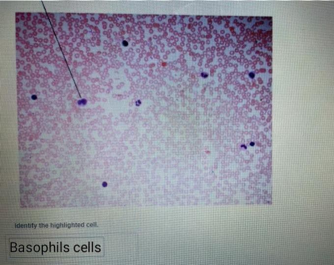 Identify the highlighted cell.
Basophils cells
