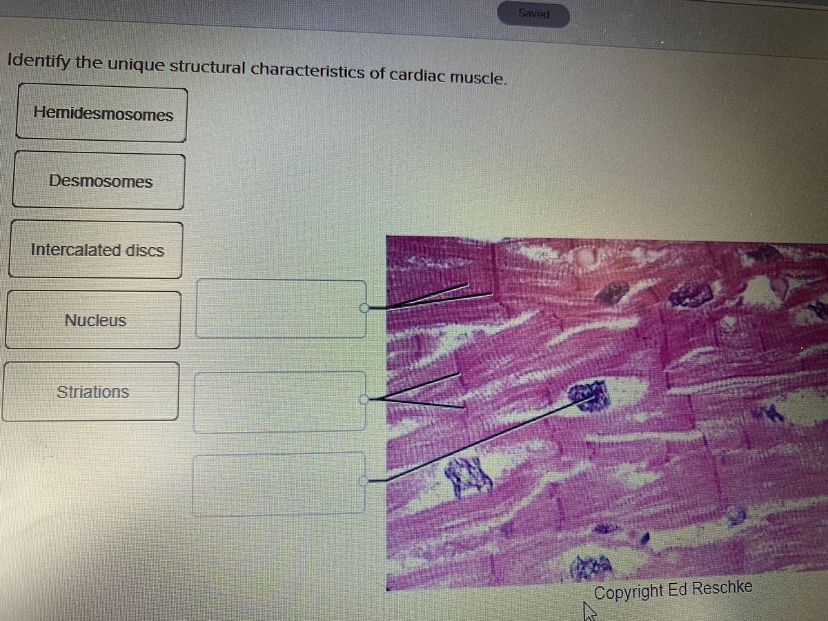 Saved
Identify the unique structural characteristics of cardiac muscle.
Hemidesmosomes
Desmosomes
Intercalated discs
Nucleus
Striations
Copyright Ed Reschke
