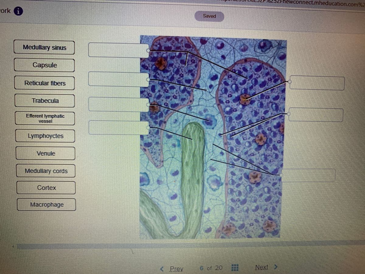 /0252Fhewconnect.mheducation.com%2
rork i
Saved
Medullary sinus
Capsule
Reticular fibers
Trabecula
Efferent lymphatic
vessel
Lymphoyctes
Venule
Medullary cords
Cortex
Macrophage
Prev
6 of 20
Next >
