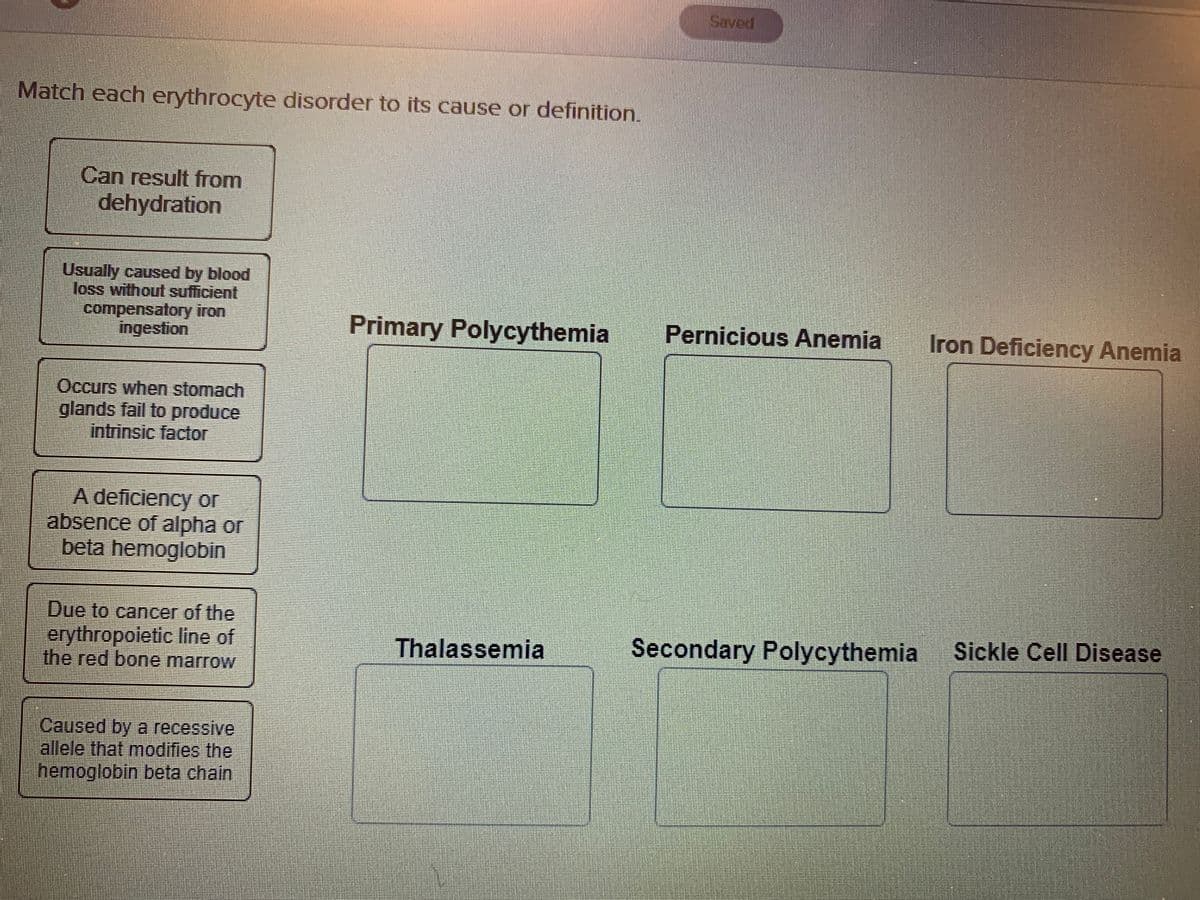 Saved
Match each erythrocyte disorder to its cause or definition.
Can result from
dehydration
Usually caused by blood
loss without sufficient
compensatory iron
ingestion
Primary Polycythemia
Pernicious Anemia
Iron Deficiency Anemia
Occurs when stomach
glands fail to produce
intrinsic factor
A deficiency or
absence of alpha or
beta hemoglobin
Due to cancer of the
Sickle Cell Disease
erythropoietic line of
the red bone marrow
Secondary Polycythemia
Thalassemia
Caused by a recessive
allele that modifies the
hemoglobin beta chain
