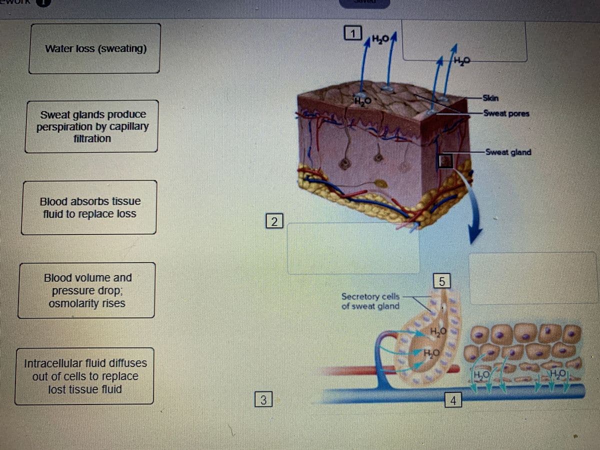 Water loss (sweating)
Skin
Sweat pores
Sweat glands produce
perspiration by capillary
filtration
Sweat gland
Blood absorbs tissue
fluid to replace loss
2
5
Blood volume and
pressure drop;,
osmolarity rises
Secretory cells
of sweat gland
H,O
Intracellular fluid diffuses
out of cells to replace
lost tissue fluid
3
4-
