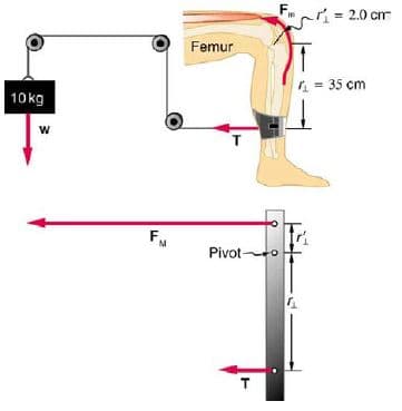 = 2.0 cm
Femur
= 35 cm
10kg
F.
Pivot o
