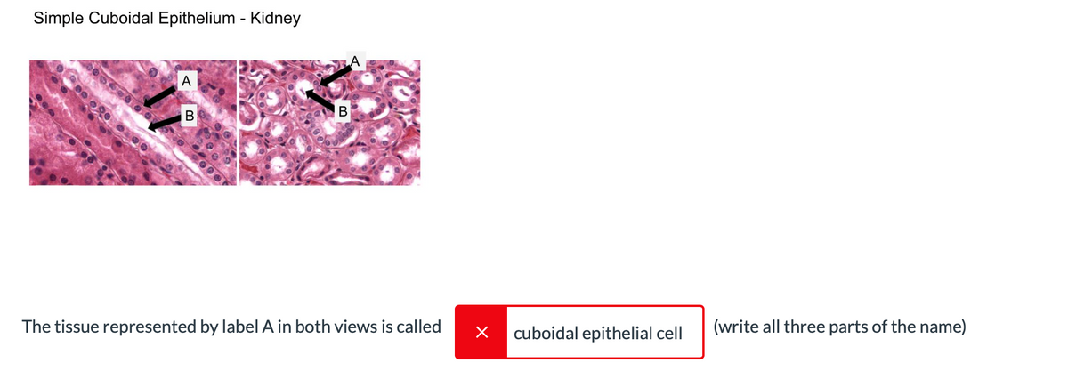 Simple Cuboidal Epithelium - Kidney
A
В
В
The tissue represented by label A in both views is called
cuboidal epithelial cell
(write all three parts of the name)
