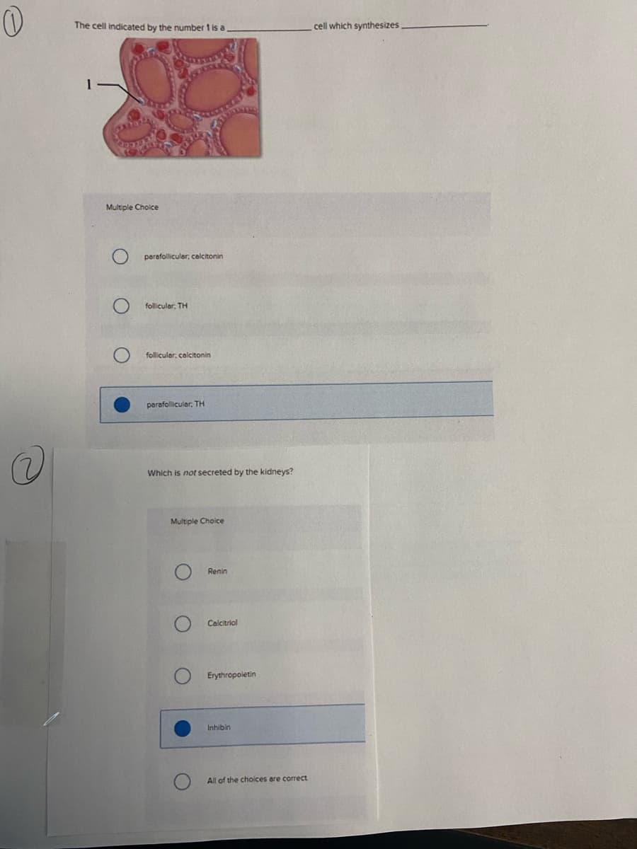 The cell indicated by the number 1 is a
cell which synthesizes.
Multiple Choice
parefolliculer, calcitonin
follicular, TH
follicular, colcitonin
perafollicular, TH
Which is not secreted by the kidneys?
Multiple Choice
Renin
Calcitriol
Erythropoletin
Inhibin
All of the choices are correct.
