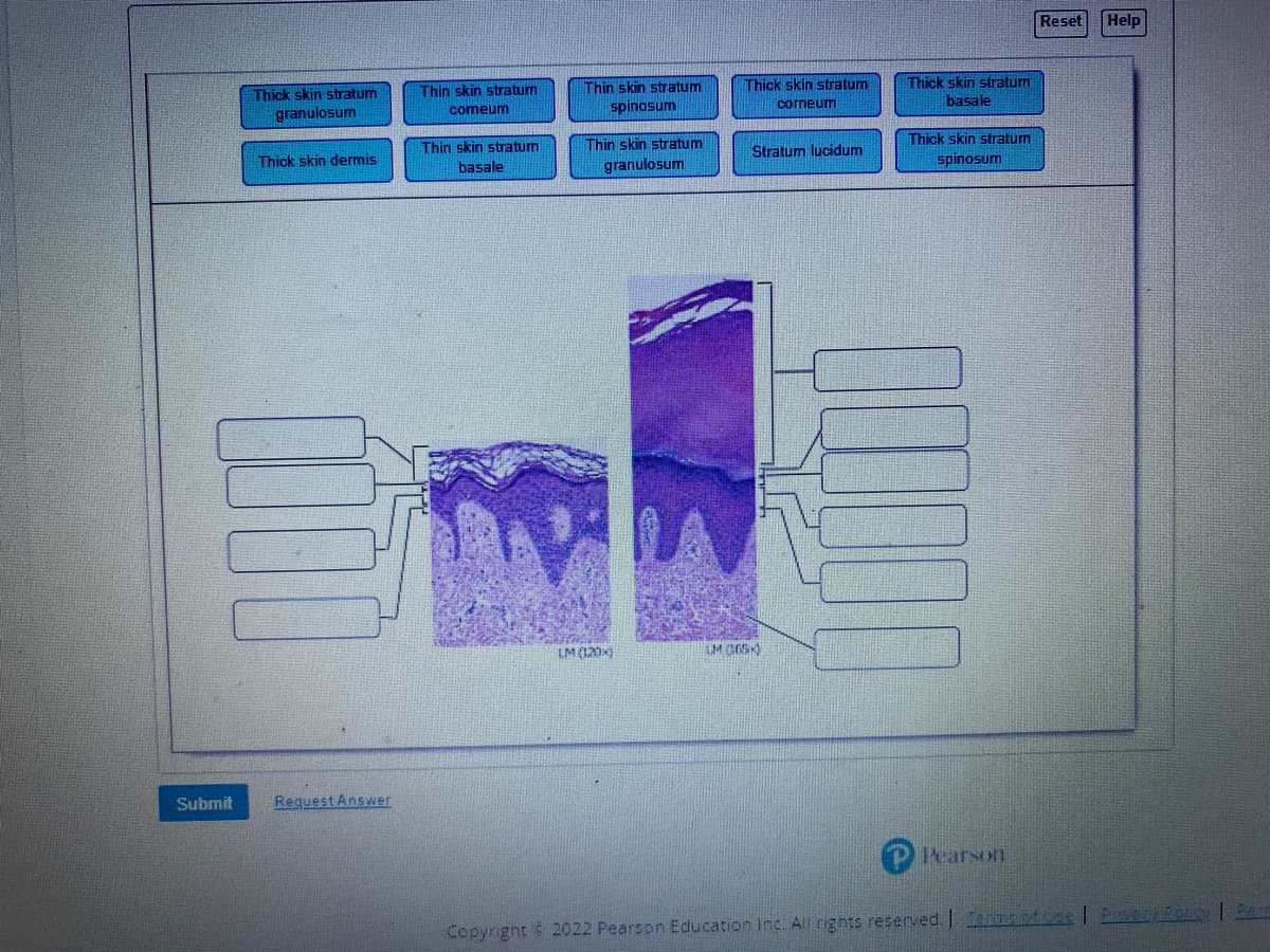 Reset
Help
Thick skin stratum
basale
Thick skin stratum
Thin skin stratum
spinosum
Thin skin stratum
Thick skin stratum
corneum
granulosum
comeum
Thick skin stratum
Thin skin stratum
Thin skin stratum
Stratum lucidum
Thick skin dermis
granulosum
spinosum
basale
IM (120)
IM G65)
Submit
Request Answer
Rrarson
Copyright 2022 Pearson Education Inc. All rights reserved. er dbse | EC Soun
