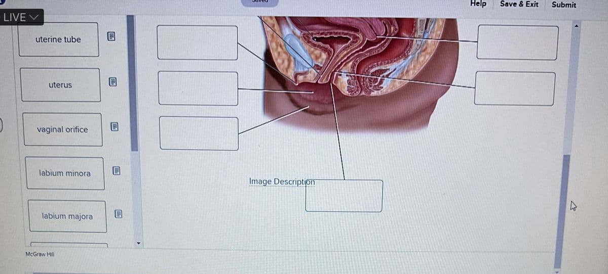 LIVE V
uterine tube
uterus
vaginal orifice
labium minora
labium majora
McGraw Hill
E
Image Description
Help Save & Exit
Submit
2