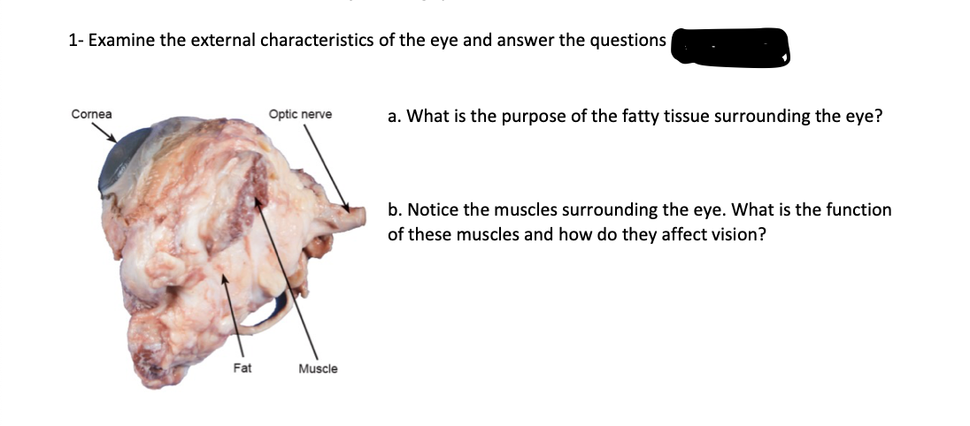 1- Examine the external characteristics of the eye and answer the questions
Cornea
Optic nerve
a. What is the purpose of the fatty tissue surrounding the eye?
b. Notice the muscles surrounding the eye. What is the function
of these muscles and how do they affect vision?
Fat
Muscle
