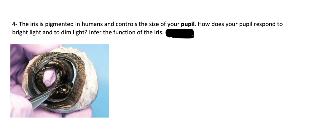 4- The iris is pigmented in humans and controls the size of your pupil. How does your pupil respond to
bright light and to dim light? Infer the function of the iris.
