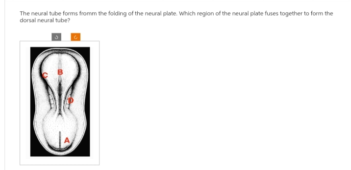 The neural tube forms fromm the folding of the neural plate. Which region of the neural plate fuses together to form the
dorsal neural tube?