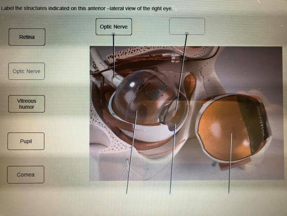 Label the structures indicated on this anterior -lateral view of the right eye.
Optic Nerve
Retina
Optic Nerve
Vitreous
humor
Pupil
Cornea
