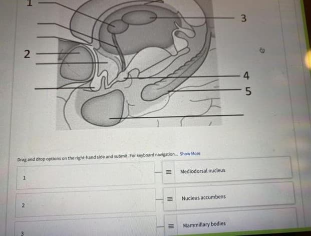 3
4
Drag and drop options on the right-hand side and submit. For keyboard navigation. Show More
Mediodorsal nucleus
Nucleus accumbens
2
Mammillary bodies
II
T.
2.
