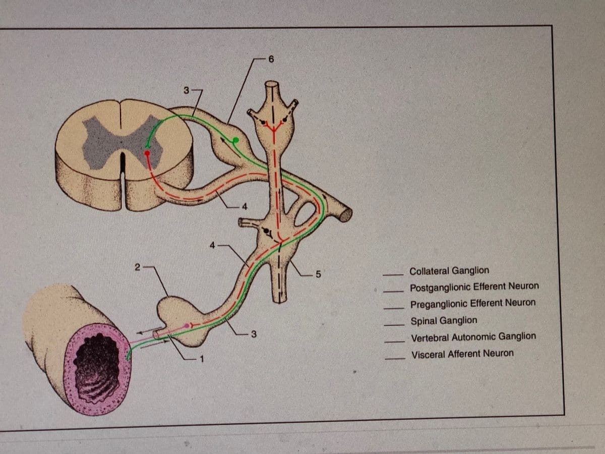 3
Collateral Ganglion
Postganglionic Efferent Neuron
Preganglionic Efferent Neuron
Spinal Ganglion
Vertebral Autonomic Ganglion
Visceral Afferent Neuron
2.
