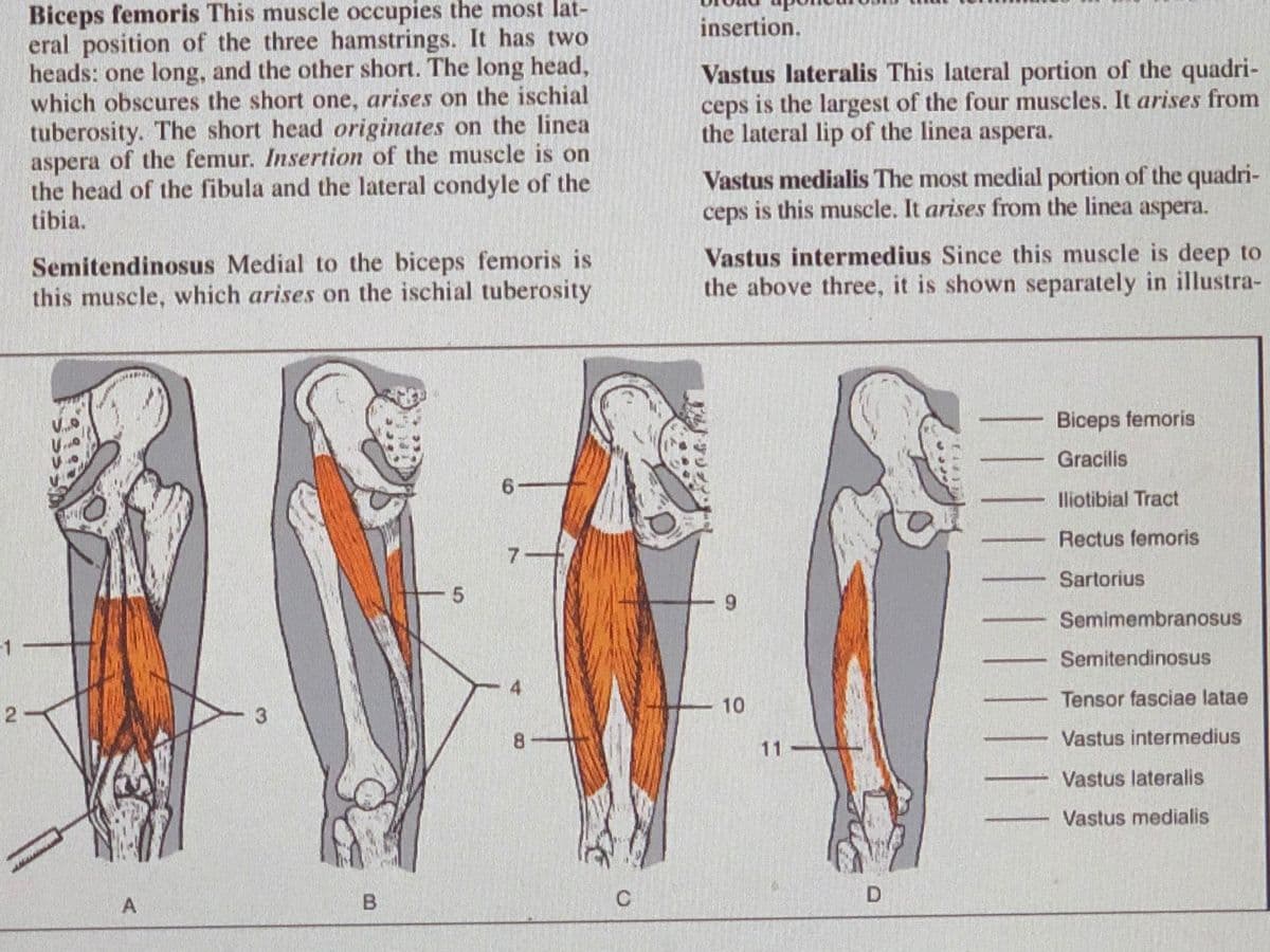 Biceps femoris This muscle occupies the most lat-
eral position of the three hamstrings. It has two
heads: one long, and the other short. The long head,
which obscures the short one, arises on the ischial
tuberosity. The short head originates on the linea
aspera of the femur. Insertion of the muscle is on
the head of the fibula and the lateral condyle of the
tibia.
insertion.
Vastus lateralis This lateral portion of the quadri-
ceps is the largest of the four muscles. It arises from
the lateral lip of the linea aspera.
Vastus medialis The most medial portion of the quadri-
ceps is this muscle. It arises from the linea aspera.
Semitendinosus Medial to the biceps femoris is
this muscle, which arises on the ischial tuberosity
Vastus intermedius Since this muscle is deep to
the above three, it is shown separately in illustra-
Biceps femoris
Gracilis
lliotibial Tract
Rectus femoris
7-
Sartorius
Semimembranosus
-1
Semitendinosus
10
Tensor fasciae latae
3.
8
Vastus intermedius
11
Vastus lateralis
Vastus medialis
A
B
2.
