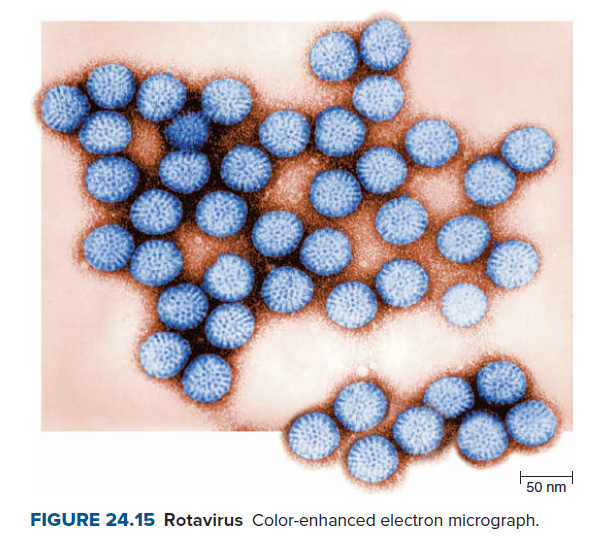 50 nm
FIGURE 24.15 Rotavirus Color-enhanced electron micrograph.
