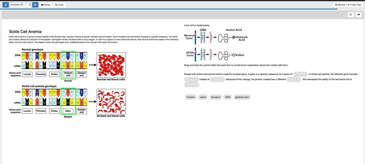 Question 24
◄►
Pause
Sickle Cell Anemia
Sickle cell anemia is a group of blood disorders that develop when a person inherits a specific recessive gene mutation. Gene mutations are permanent changes in a genetic sequence. The sickle
cell mutation affects the structure of hemoglobin; hemoglobin allows red blood cells to carry oxygen. In order for a person to have sickle cell anemia, they have to inherit two copies of the recessive
allele, one from each parent. The diagram shows the genotypes of an unaffected person and a person with sickle cell anemia.
Amino acid
sequence
Q Zoom
Normal genotype
DNA GAC TGA GGA CTC
mRNA CLUIG ACU
CCUGAGGAG
Glutamic
acid
Normal
Leucine Threonine Proline
mRNA CUG| ACU CCUGUG
Amino acid
sequence
CTC
Sickle cell anemia genotype
DNA GAC TGA GGA CAC CTC
Leucine Threonine Proline
Valine
Mutant
Glutamic
acid
GAG
Glutamic
acid
Normal red blood cells
Culor
Docil
Sickled red blood cells
Look at the model below.
DNA
1-1-1-0²
Normal
Gene
Sickle
Gene
|-H-I-²
Drag and drop the correct label into each box to construct an explanation about how sickle cells form.
function
valine
Amino Acid
People with sickle cell anemia inherit a specific mutated gene. A gene is a specific sequence on a piece of
instead of
Because of this change, the protein created has a different
structure
.
OGlutamic
Acid
DNA
OValine
glutamic acid
Q Review /✔ Finish Test
In sickle cell anemia, the affected gene includes
This decreases the ability of the red blood cell to