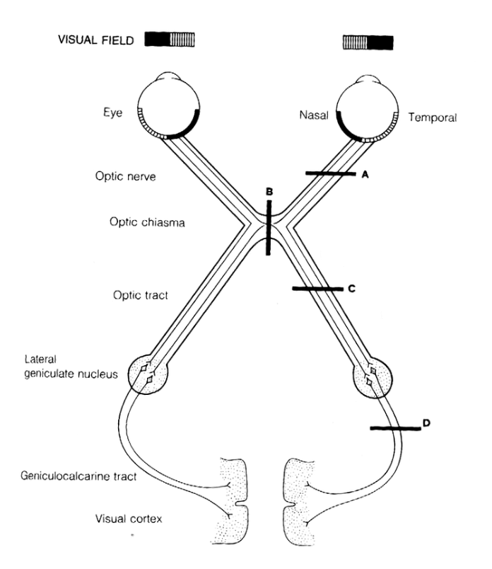 VISUAL FIELD
Eye
Optic nerve
Optic chiasma
Optic tract
Lateral
geniculate nucleus
Geniculocalcarine tract
Visual cortex
B
Nasal
C
Temporal