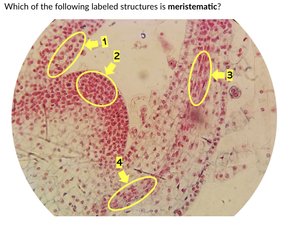 Which of the following labeled structures is meristematic?
2
