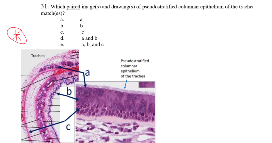 31. Which paired image(s) and drawing(s) of pseudostratified columnar epithelium of the trachea
match(es)?
а.
a
b.
с.
a and b
a, b, and c
d.
е.
Trachea
Pseudostratified
columnar
ja
epithelium
of the trachea
