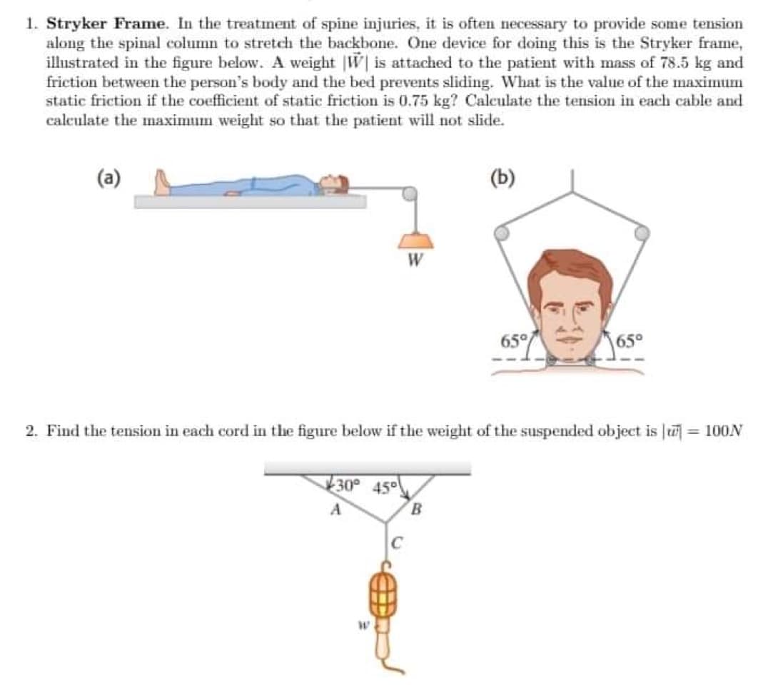 1. Stryker Frame. In the treatment of spine injuries, it is often necessary to provide some tension
along the spinal column to stretch the backbone. One device for doing this is the Stryker frame,
illustrated in the figure below. A weight. W is attached to the patient with mass of 78.5 kg and
friction between the person's body and the bed prevents sliding. What is the value of the maximum
static friction if the coefficient of static friction is 0.75 kg? Calculate the tension in each cable and
calculate the maximum weight so that the patient will not slide.
W
30° 45°
A
2. Find the tension in each cord in the figure below if the weight of the suspended object is = 100N
(b)
B