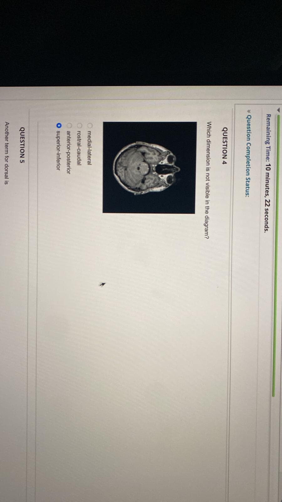 Remaining Time: 10 minutes, 22 seconds.
* Question Completion Status:
QUESTION 4
Which dimension is not visible in the diagram?
medial-lateral
Orostral-caudal
O anterior-posterior
O superior-inferior
QUESTION 5
Another term for dorsal is