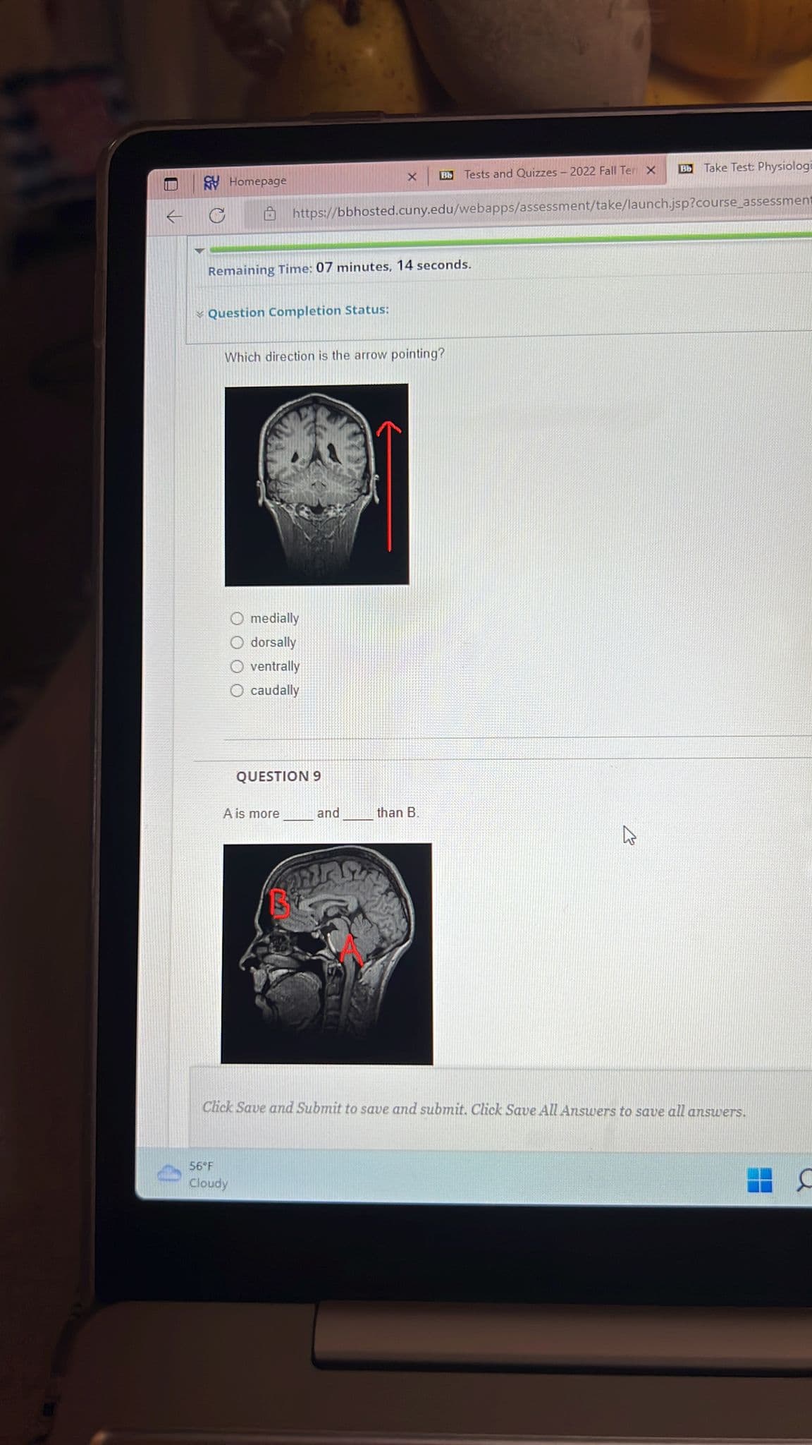 Homepage
Question Completion Status:
Remaining Time: 07 minutes, 14 seconds.
Which direction is the arrow pointing?
O medially
dorsally
ventrally
O caudally
A is more
56°F
Cloudy
https://bbhosted.cuny.edu/webapps/assessment/take/launch.jsp?course_assessment
QUESTION 9
X
and
Bb Tests and Quizzes - 2022 Fall Ter X
than B.
VELASIE
Bb
Take Test: Physiologi
Click Save and Submit to save and submit. Click Save All Answers to save all answers.
C