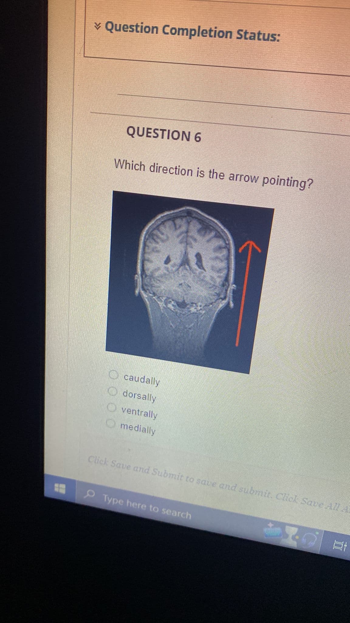 ✓ Question Completion Status:
QUESTION 6
Which direction is the arrow pointing?
caudally
dorsally
Oventrally
medially
Click Save and Submit to save and submit. Click Save Al A
Type here to search