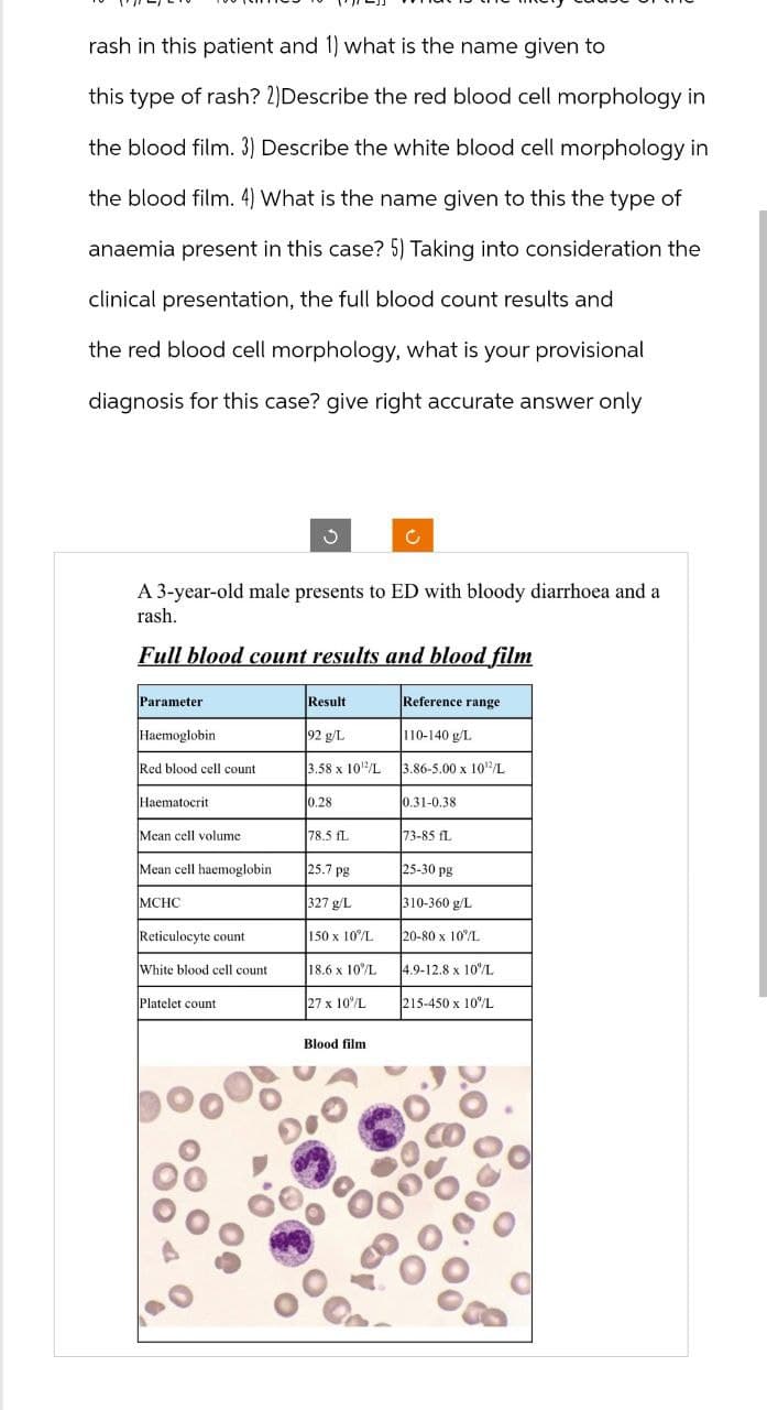 rash in this patient and 1) what is the name given to
this type of rash? 2)Describe the red blood cell morphology in
the blood film. 3) Describe the white blood cell morphology in
the blood film. 4) What is the name given to this the type of
anaemia present in this case? 5) Taking into consideration the
clinical presentation, the full blood count results and
the red blood cell morphology, what is your provisional
diagnosis for this case? give right accurate answer only
د
A 3-year-old male presents to ED with bloody diarrhoea and a
rash.
Full blood count results and blood film
Parameter
Result
Reference range
Haemoglobin
92 g/L
110-140 g/L
Red blood cell count
3.58 x 102/L
3.86-5.00 x 102/L
Haematocrit
0.28
0.31-0.38
Mean cell volume
78.5 fL
73-85 fl
Mean cell haemoglobin
25.7 pg
25-30 pg
MCHC
327 g/L
310-360 g/L
Reticulocyte count
150 x 10%/L
20-80 x 10%/L
White blood cell count
18.6 x 10%/L
4.9-12.8 x 10%/L
Platelet count
27 x 10%/L
215-450 x 10%/L
00
Blood film
De