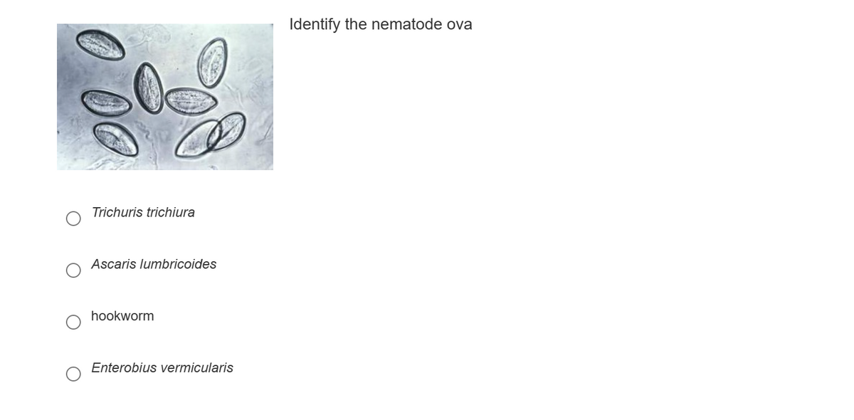 Trichuris trichiura
Ascaris lumbricoides
hookworm
Enterobius vermicularis
Identify the nematode ova