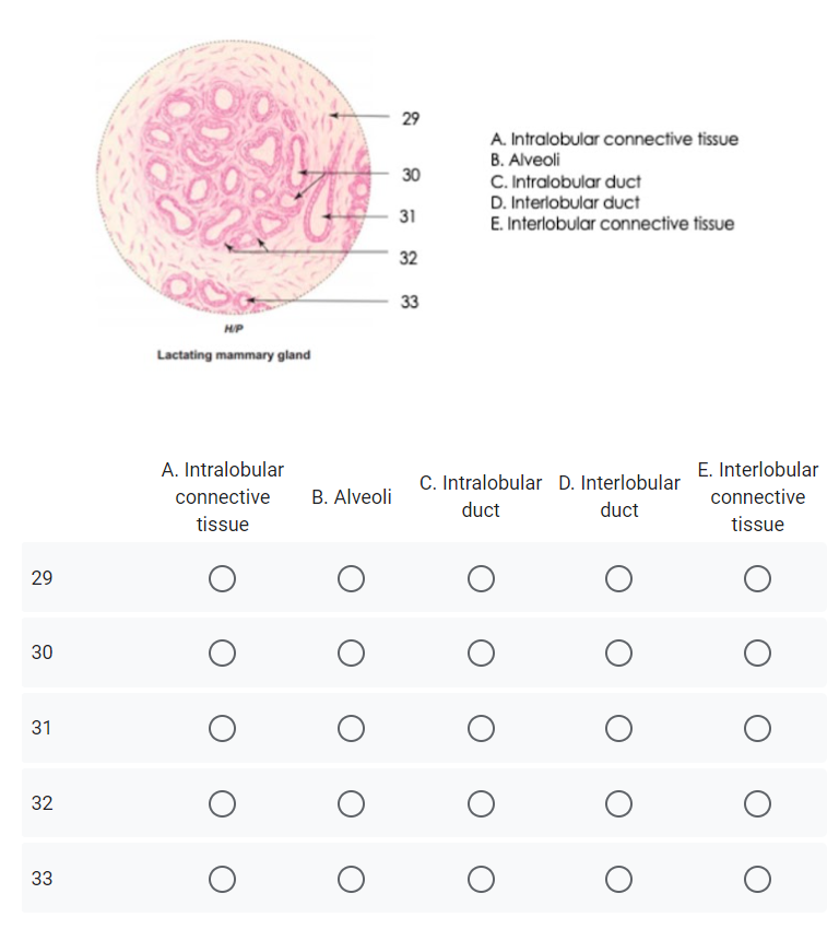 29
A. Intralobular connective tissue
B. Alveoli
30
C. Intralobular duct
D. Interlobular duct
31
E. Interlobular connective tissue
32
33
HIP
Lactating mammary gland
A. Intralobular
E. Interlobular
C. Intralobular D. Interlobular
connective
B. Alveoli
connective
duct
duct
tissue
tissue
29
30
32
33
31
