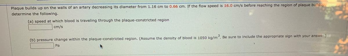 ---

### Blood Flow Dynamics through Constricted Arteries

Plaque builds up on the walls of an artery decreasing its diameter from **1.16 cm** to **0.66 cm**. If the flow speed is **16.0 cm/s** before reaching the region of plaque buildup, determine the following:

#### (a) Speed at which blood is traveling through the plaque-constricted region
\[ \_\_\_\_\_\_\_\_ \, \text{cm/s} \]

#### (b) Pressure change within the plaque-constricted region
(Assume the density of blood is **1050 kg/m³**. Be sure to include the appropriate sign with your answer.)
\[ \_\_\_\_\_\_\_\_ \, \text{Pa} \]

---

To solve these problems, you would typically use the principles of fluid dynamics such as the continuity equation and Bernoulli’s principle.

