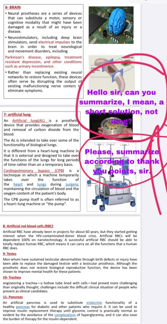 6- BRAIN
• Neural prostheses are a series of devices
that can substitute a motor, sensory or
cognitive modality that might have been
damaged as a result of an injury or a
disease.
• Neurostimulators, including deep brain
stimulators, send electrical impulses to the
brain in order to treat neurological
and movement disorders, including
Parkinson's disease, epilepsy, treatment
resistant depression, and other conditions
such as urinary incontinence.
• Rather than replacing existing neural
networks to restore function, these devices
often serve by disrupting the output of
existing malfunctioning nerve centers t
eliminate symptoms.
Hello sir, can you
summarize, I mean, a
short solution, not
7- artificial lung
An Artificial lung(AL)_is
device that provides oxygenation of blood
prosthet
and removal of carbon dioxide from the
blood.
The AL is intended to take over some of the
functionality of biological lungs.
It is different from a heart-lung machine in Please, summarize
that it is external and designed to take over
the functions of the lungs for long periods
of time rather than on a temporary basis.
Cardiopulmonary bypass (CPB)
technique in which a machine temporarily
takes
according to thank
you points, sir.
is
a
over
the
function
of
the heart and lungs during surgery,
maintaining the circulation of blood and the
oxygen content of the patient's body.
The CPB pump itself is often referred to as
a heart-lung machine or "the pump".
8- Artificial red blood cells (RBC)
Artificial RBC have already been in projects for about 60 years, but they started getting
interest when the HIV-contaminated-donor blood crisis. Artificial RBCS will be
dependent 100% on nanotechnology. A successful artificial RBC should be able to
totally replace human RBC, which means it can carry on all the functions that a human
RBC does.
9- Testes
Men whom have sustained testicular abnormalities through birth defects or injury have
been able to replace the damaged testicle with a testicular prosthesis. Although the
prosthetic does not restore biological reproductive function, the device has been
shown to improve mental health for these patients
10- Trachea
engineering a trachea-a hollow tube lined with cells-had proved more challenging
than originally thought; challenges include the difficult clinical situation of people who
present as clinical candidates.
11- Pancreas
An artificial pancreas is used to substitute endocrine functionality of
healthy pancreas for diabetic and other patients who require it. It can be used to
improve insulin replacement therapy until glycemic control is practically normal as
evident by the avoidance of the complications of hyperglycemia, and it can also ease
the burden of therapy for the insulin-dependent.
a
