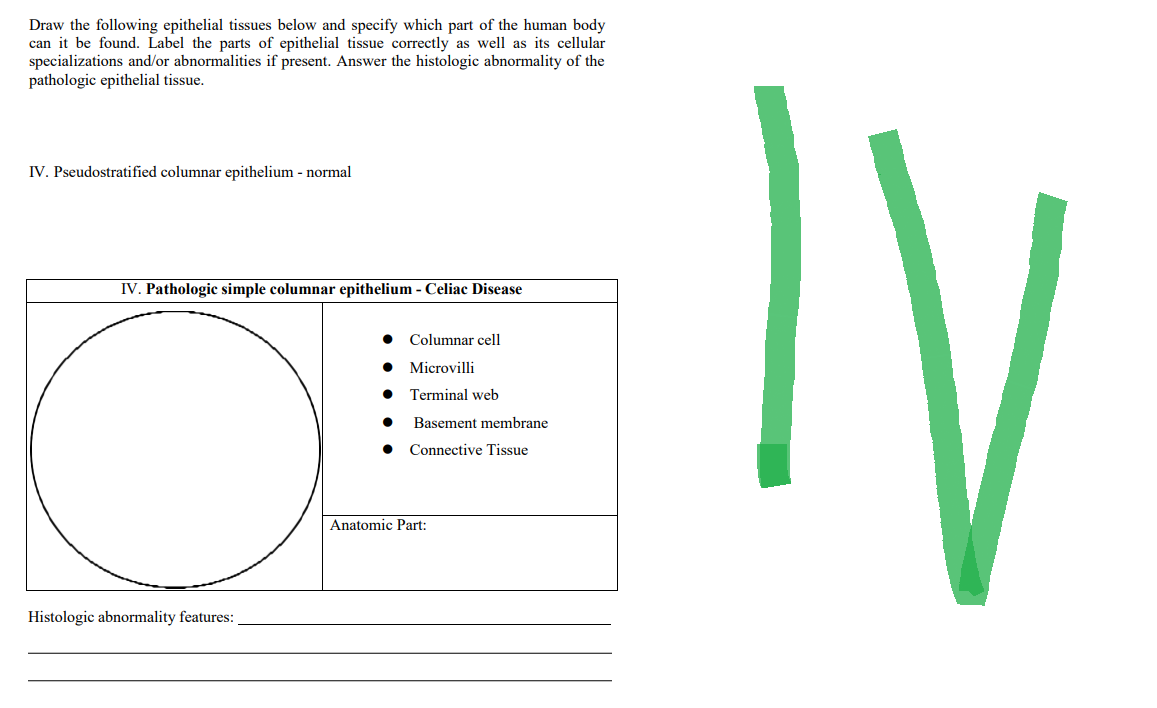 Draw the following epithelial tissues below and specify which part of the human body
can it be found. Label the parts of epithelial tissue correctly as well as its cellular
specializations and/or abnormalities if present. Answer the histologic abnormality of the
pathologic epithelial tissue.
IV. Pseudostratified columnar epithelium - normal
IV. Pathologic simple columnar epithelium - Celiac Disease
Histologic abnormality features:
Columnar cell
● Microvilli
Terminal web
Basement membrane
● Connective Tissue
Anatomic Part:
IV